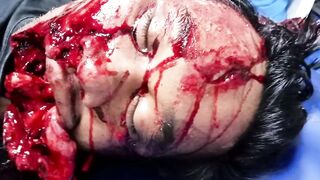 Medical Compilation