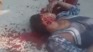 Local Congress Worker Got Throat Slit By Rioters In Bengal