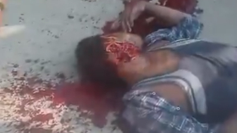 Local Congress Worker Got Throat Slit By Rioters In Bengal