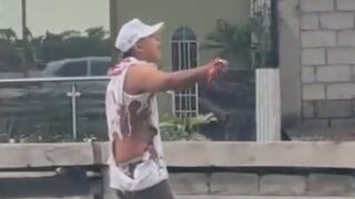 Extortionis Lost Palm After Self Made Bomb Explosion
