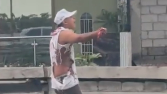 Extortionis Lost Palm After Self Made Bomb Explosion