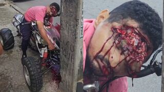 Instant Death: Man Crashes ATV Head-On Into Concrete Post