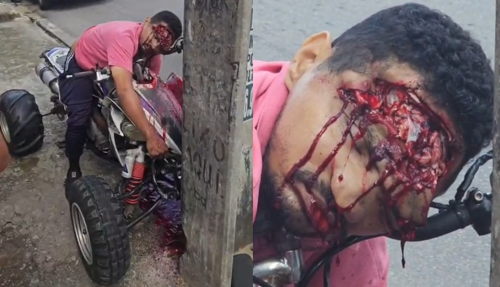 Instant Death: Man Crashes ATV Head-On Into Concrete Post