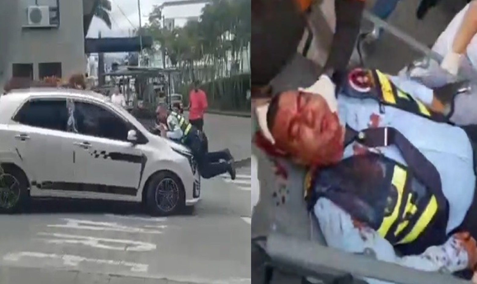 Horrific Attack: Transit Cop Slashed with Machete & Dragged by Vehicle in Colombia