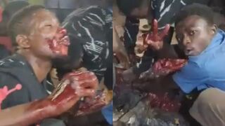 Cannibal Party In Congo