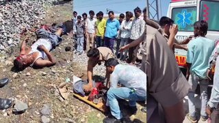 Train destroys mans legs