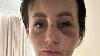 In Kazan, a man brutally beat his ex-wife