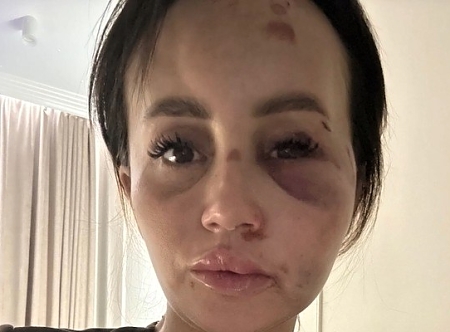In Kazan, a man brutally beat his ex-wife