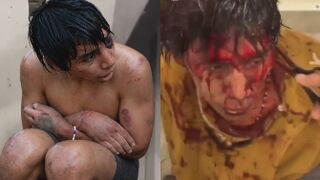 Kidnapped Man Savagely Tortured By Cartel