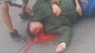 Man Literally Falls Apart Following Street Shooting