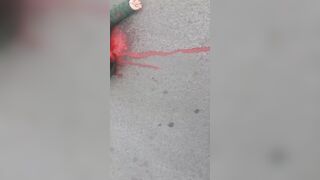 Man Literally Falls Apart Following Street Shooting