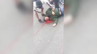 Man Literally Falls Apart Following Street Shooting