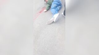 Man Literally Falls Apart Following Street Shooting