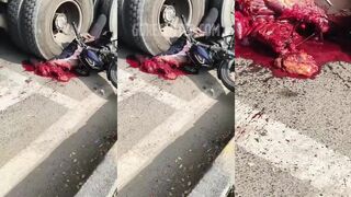 Terrible Aftermath Of Motorcycle Accident