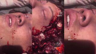 Man with exploded head still in agony.
