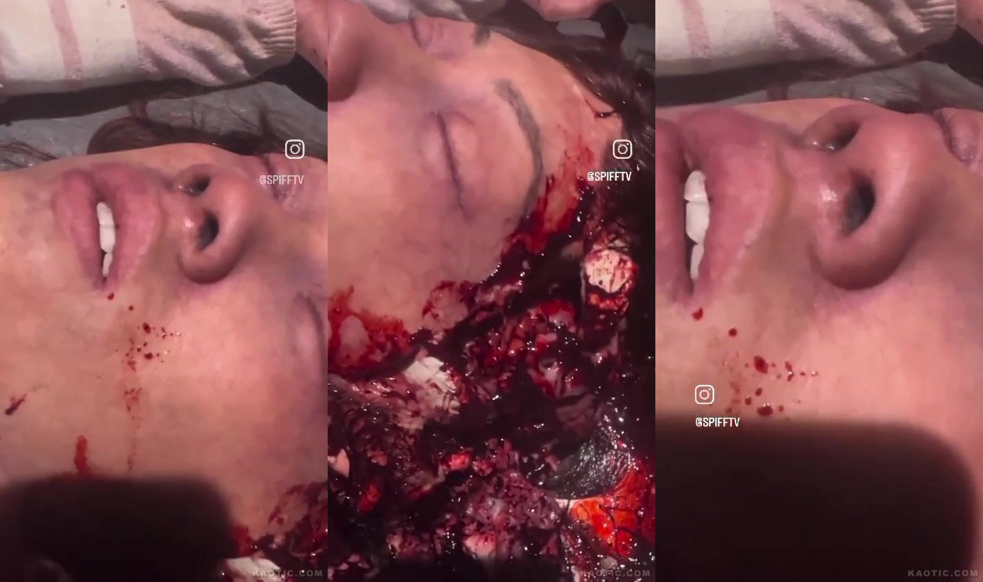 Man with exploded head still in agony.