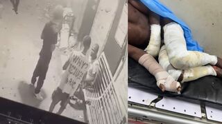 Horror in Barahona: Young Man Allegedly Sets Fire to Person with Mental Health Issues