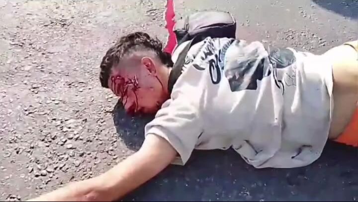 Dead when head smacks pavement