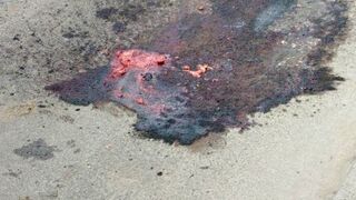 Shocking: Garbage truck rips off 88-year-old woman’s head