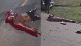 One Killed Another Dismembered Following Motorcycle Accident In Brazil
