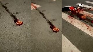 Classic :Girl's heart ejected and still beating