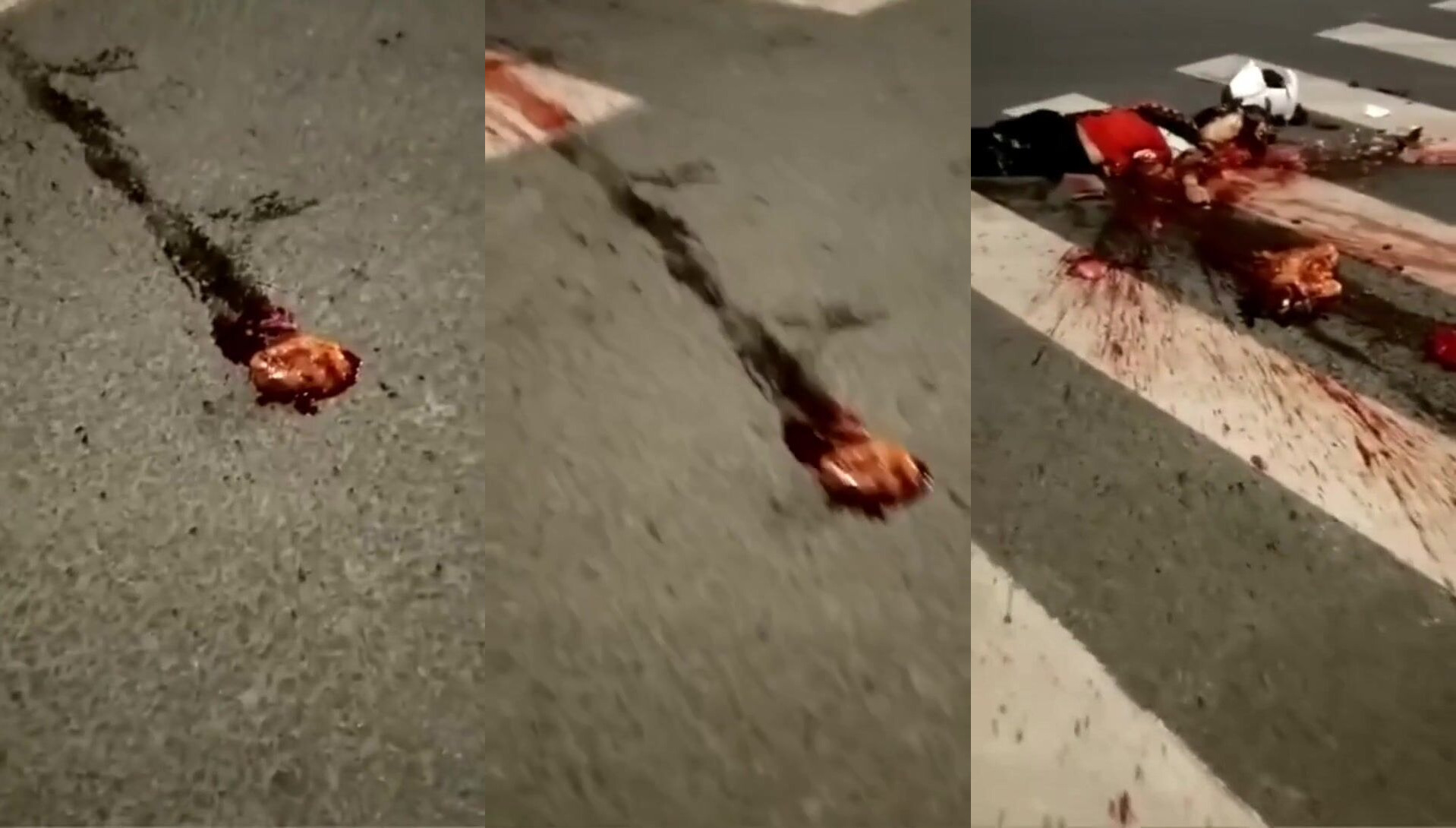 Classic :Girl's heart ejected and still beating
