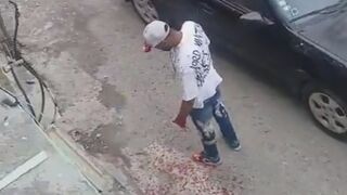 Man Lost Palm During Machete Fight