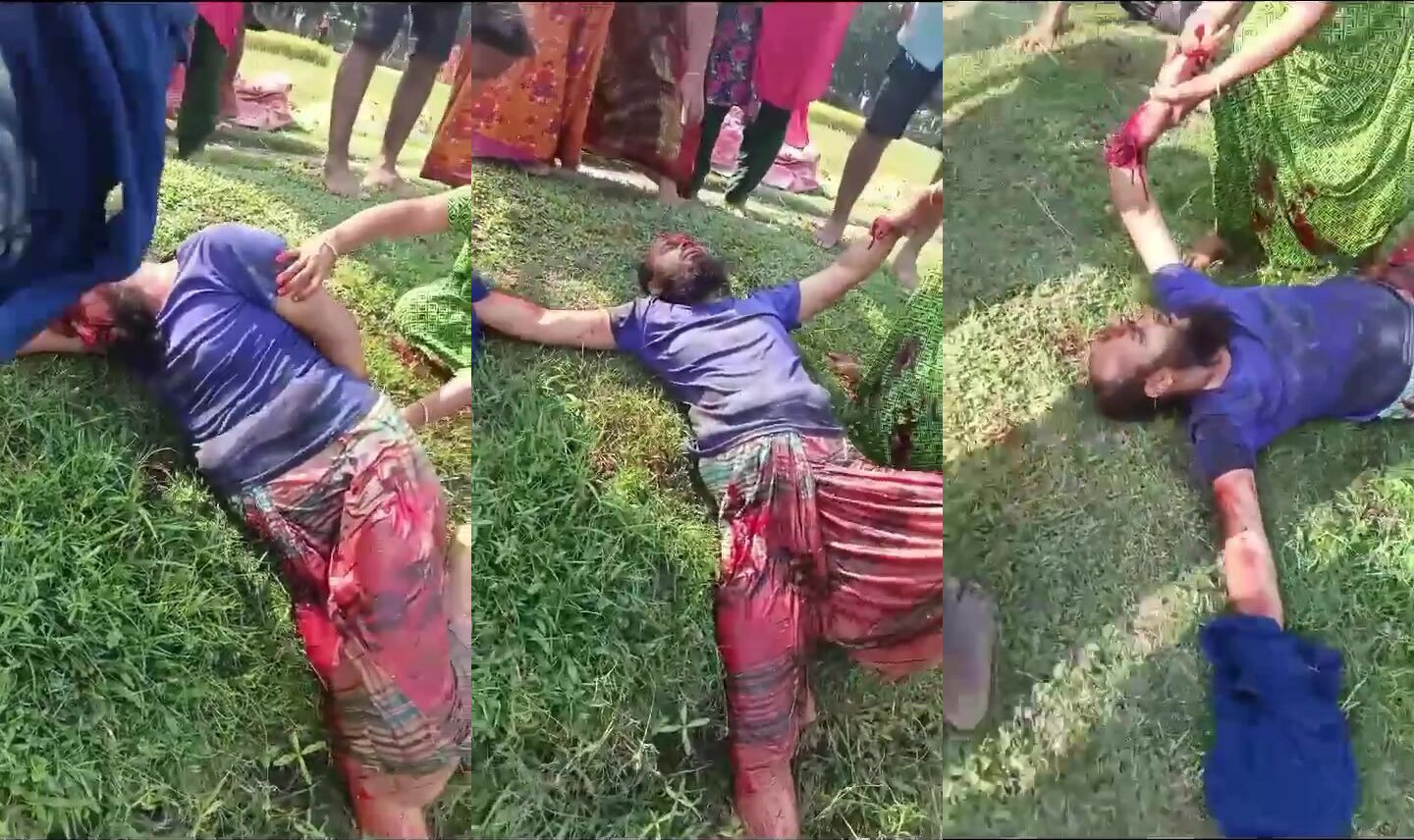 Dispute ends with one severly injured