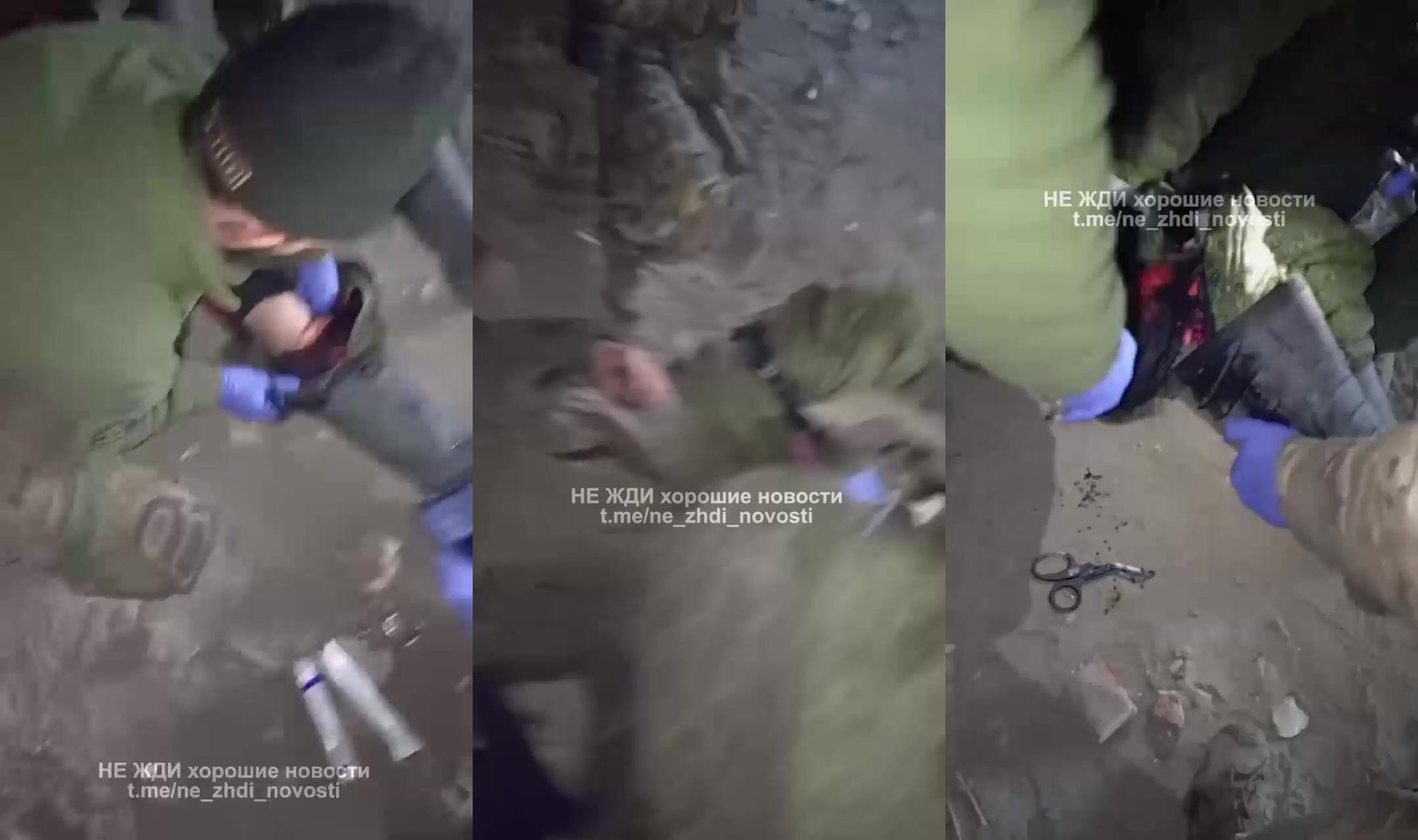 The Russians cut off the leg of one of their own