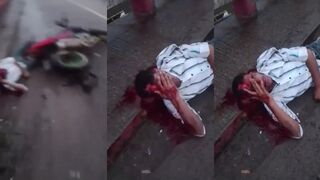 Man Partlially Scalped Following Motorcycle Accident