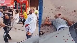 Lost Palm And One Dying: Result Of A Brutal Fight Outside Of Estate Agency