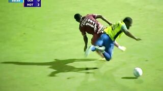 The football player broke his ankle