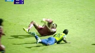 The football player broke his ankle
