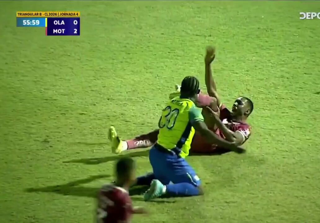 The football player broke his ankle
