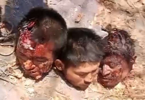 Dismembered Limbs and Gutted Bodies to Celebrate Total Annihilation of Enemies