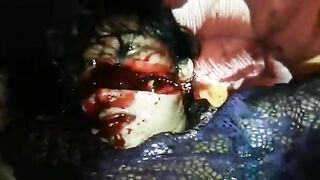 Classic: Ms. Pacman video (Woman with her mutilated face)