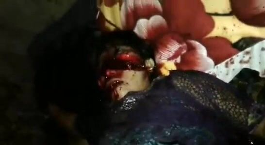 Classic: Ms. Pacman video (Woman with her mutilated face)