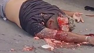 Motorcyclist ended up dying, his skull crushed