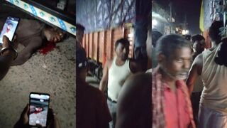 Eyes bulged after hit by truck