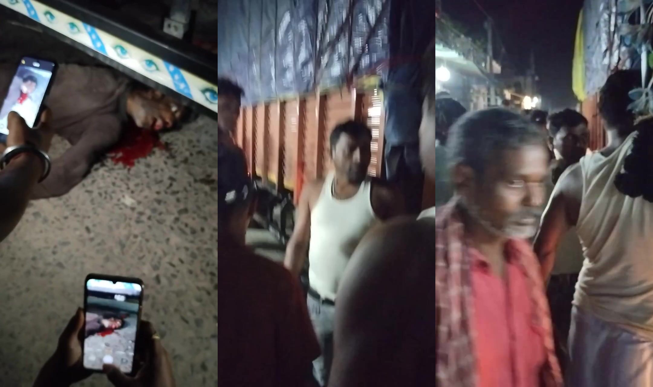 Eyes bulged after hit by truck
