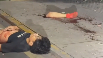 Man Shocked And Silent After Losing Leg In Traffic Accident