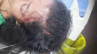 Evil Dude Attacks GF With A Stone In Broad Daylight