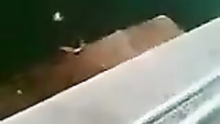 Classic: A guy slipped and sustained a fatal head injury (Face split diving accident)