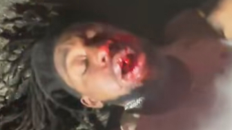 Texas Couple Gets Nasty Beating After A Fight Of Females Goes Out Of Control