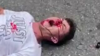 Collision Between Two Motorcycles Leaves Four Dudes In Pain In Suffering