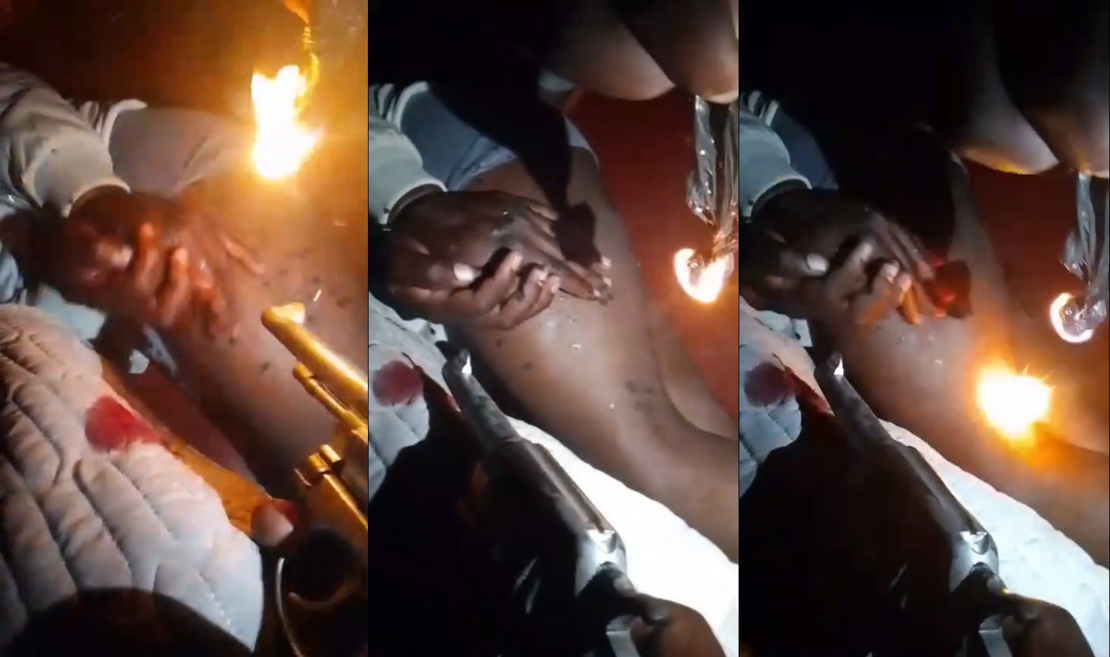 Kidnappers Pour Molten Plastic on Screaming Victim While Holding Him at Gunpoint