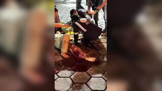 Poor Woman Suffers Terrible Leg Injury Fully Awake