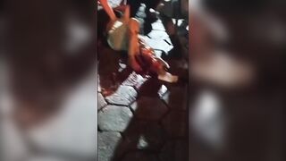 Poor Woman Suffers Terrible Leg Injury Fully Awake