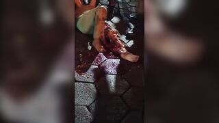 Poor Woman Suffers Terrible Leg Injury Fully Awake