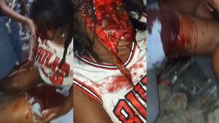 Two women in car crash. One of them lost her face.